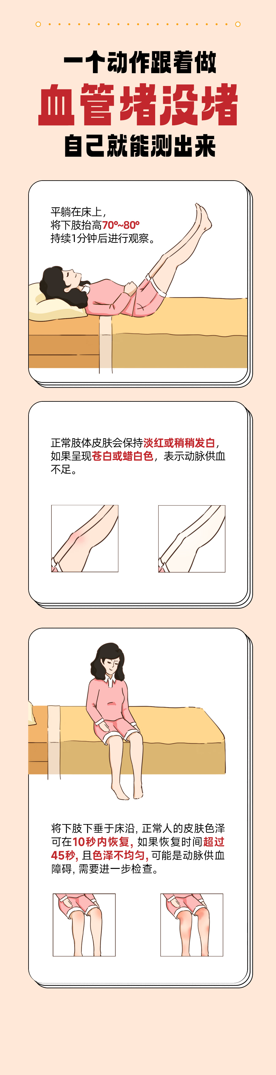 一个动作跟着做
 血管堵没堵
 自己就能测出来
 平躺在床上，将下肢抬高70°~80°持续1分钟后进行观察。
 正常肢体皮肤会保持淡红或稍稍发白，如果呈现苍白或蜡白色，表示动脉供血不足。
 将下肢下垂于床沿，正常人的皮肤色泽可在10秒内恢复，如果恢复时间超过45秒，且色泽不均匀，可能是动脉供血障碍，需要进一步检查。