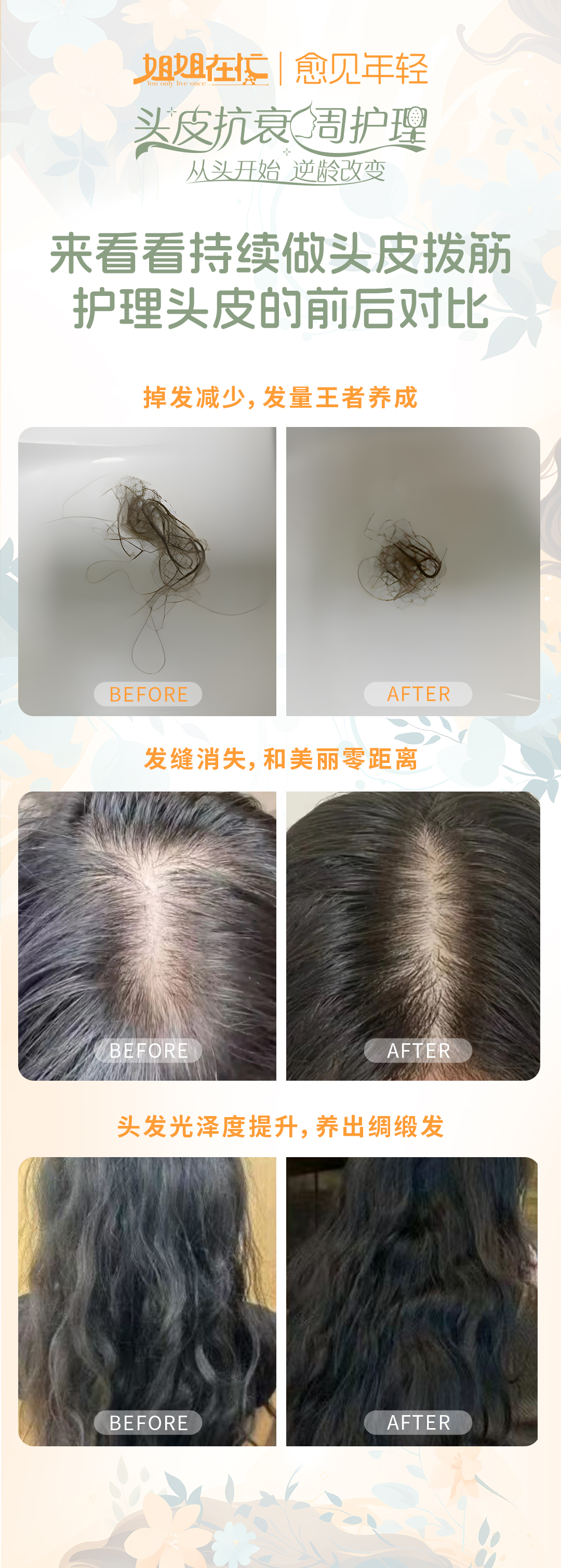 第0天-长期做头皮拨筋的前后对比 姐姐在忙 | 愈见年轻
头皮抗衰周护理
从头开始逆龄改变
来看看持续做头皮拔筋护理头皮的前后对比
掉发减少,发量王者养成
发缝消失,和美丽零距离
头发光泽度提升,养出绸缎发