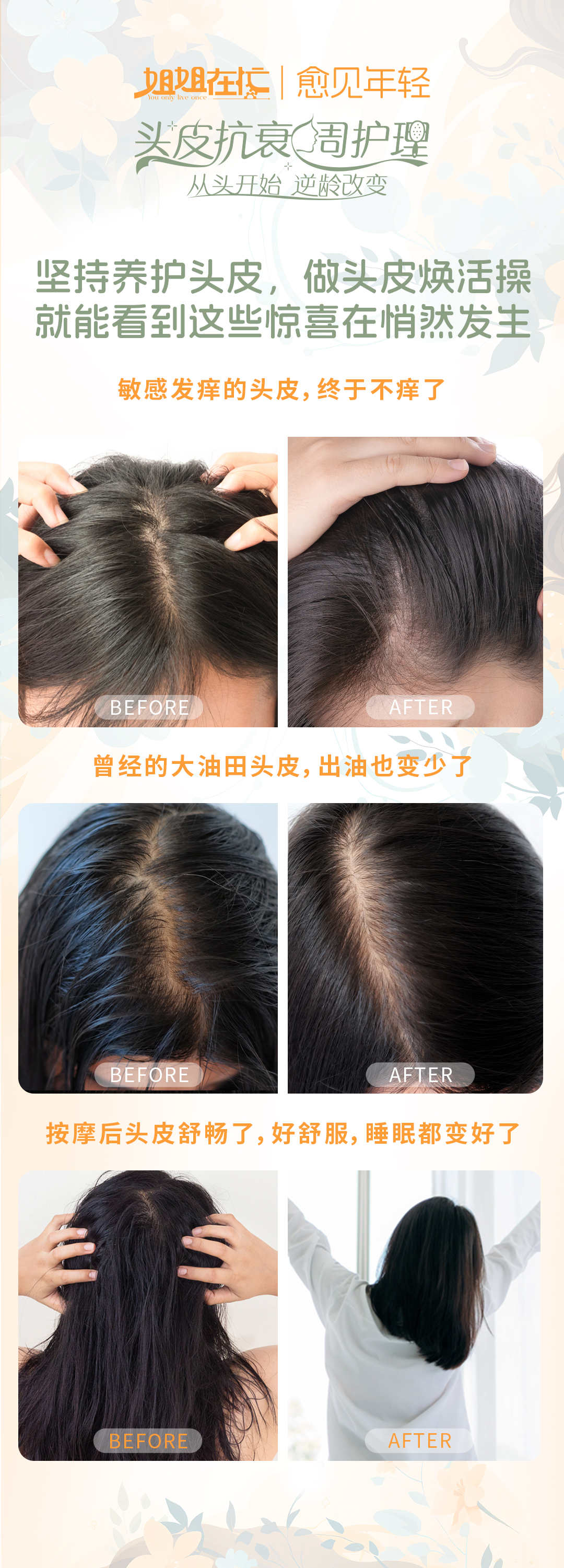 姐姐在忙 | 愈见年轻
 头皮抗衰周护理
 从头开始 逆龄改变
 坚持养护头皮，做头皮焕活操就能看到这些惊喜在悄然发生
 敏感发痒的头皮，终于不痒了
 曾经的大油田头皮，出油也变少了
 按摩后头皮舒畅了，好舒服，睡眠都变好了