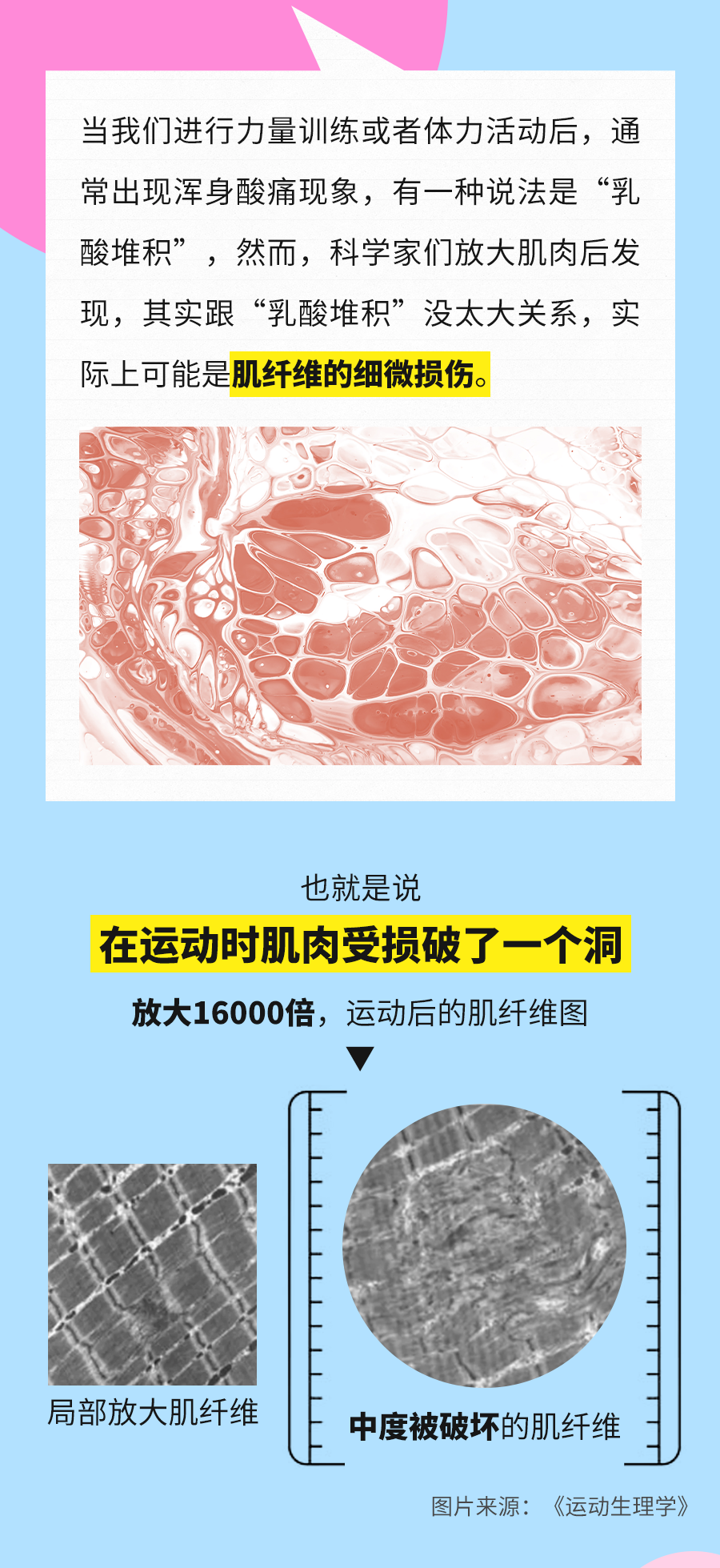 当我们进行力量训练或者体力活动后，通常出现浑身酸痛现象，有一种说法是“乳酸堆积”，然而，科学家们放大肌肉后发现，其实跟“乳酸堆积”没太大关系，实际上是肌纤维的细微损伤。
 也就是说
 在运动时肌肉受损破了一个洞
 放大16000倍，运动后的肌纤维图
 中度被破坏的肌纤维
 图片来源：《运动生理学》