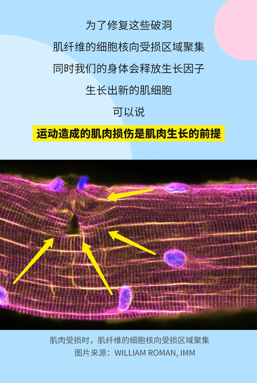 为了修复这些破洞
 肌纤维的细胞核向受损区域聚集
 同时我们的身体会释放生长因子
 生长出新的肌细胞
 可以说
 运动造成的肌肉损伤是肌肉生长的前提
 肌肉受损时，肌纤维的细胞核向受损区域聚集
 图片来源：WILLIAM ROMAN, IMM