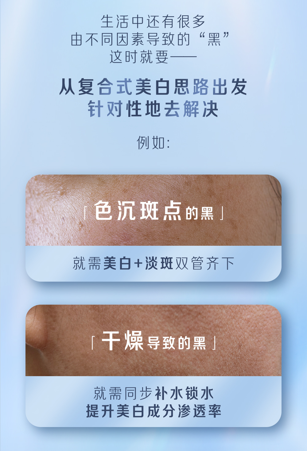 生活中还有很多
 由不同因素导致的“黑”
 这时就要——
 从复合式美白思路出发
 针对性地去解决
 例如：
 「色沉斑点的黑」
 就需美白+淡斑双管齐下
 「干燥导致的黑」
 就需同步补水锁水
 提升美白成分渗透率