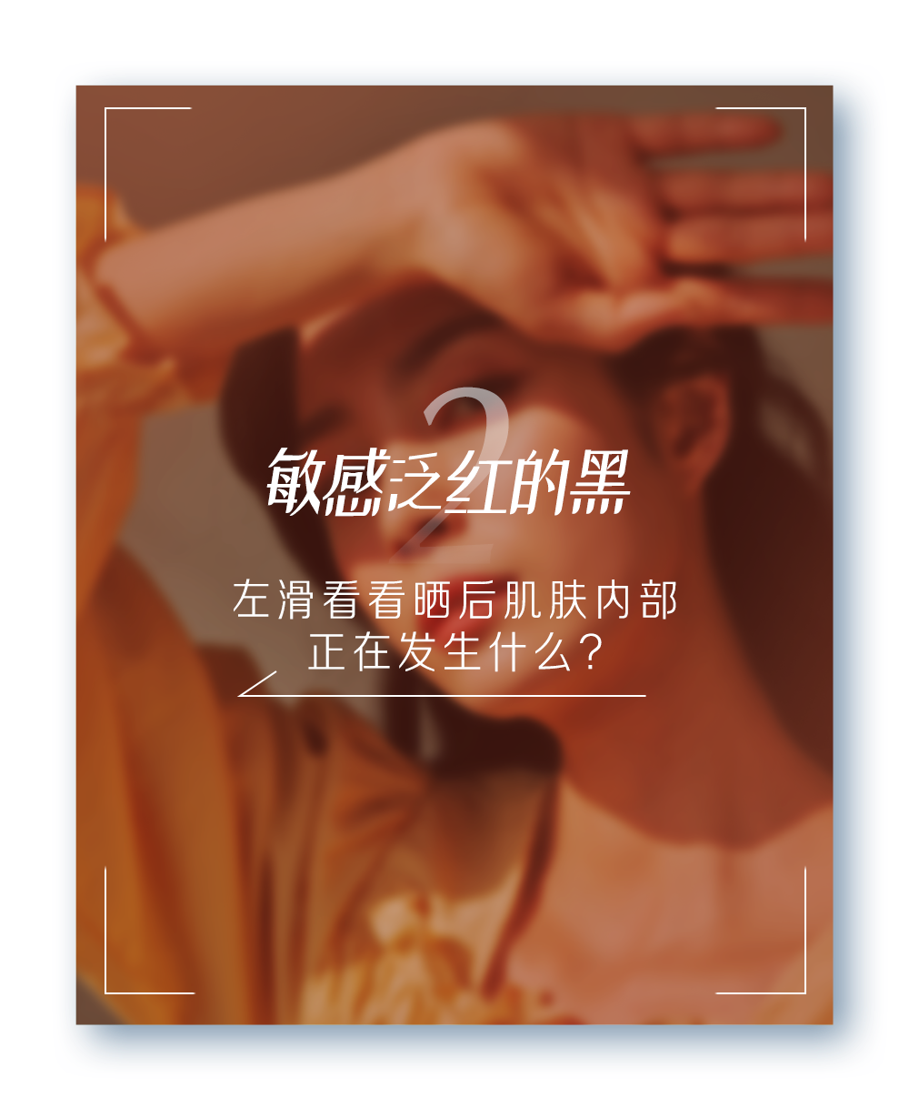 敏感泛红的黑
左滑看看晒后肌肤内部正在发生什么？