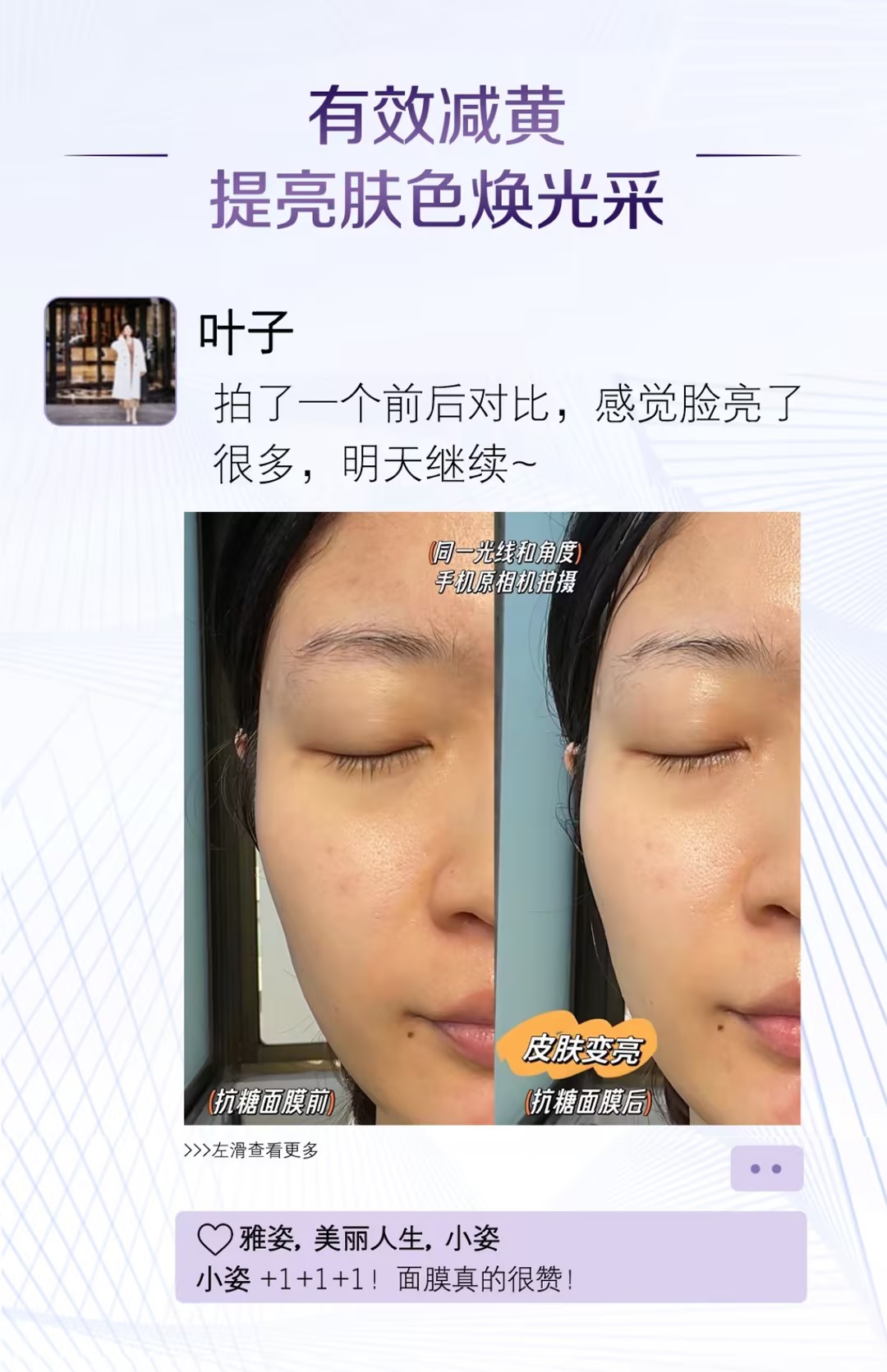 有效减黄
 提亮肤色焕光采
 叶子
 拍了一个前后对比，感觉脸亮了很多，明天继续~
 同一光线和角度 手机原相机拍摄
 抗糖面膜前
 抗糖面膜后 皮肤变亮
 雅姿, 美丽人生, 小姿
 小姿 +1+1+1！面膜真的很赞！