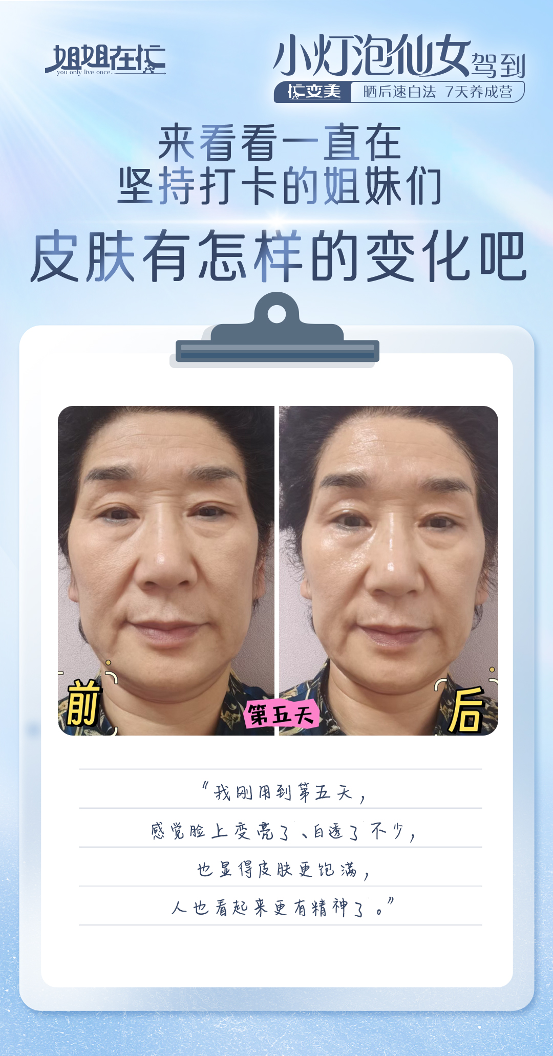 姐姐在忙 You only live once
 小灯泡仙女驾到
忙变美 晒后速白法 7天养成营
 来看看一直在坚持打卡的姐妹们
 皮肤有怎样的变化吧
 前
 第五天
 后
 “我刚用到第五天，感觉脸上变亮了、白透了不少，也显得皮肤更饱满，人也看起来更有精神了。”