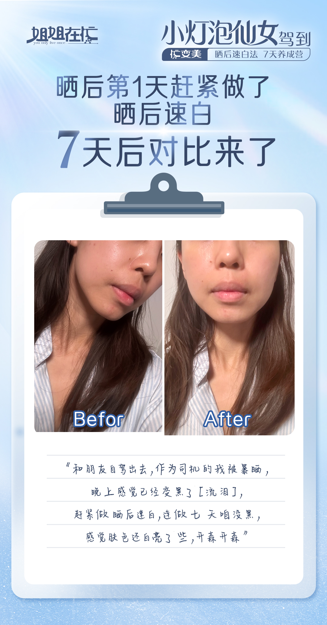 姐姐在忙 You only live once
 小灯泡仙女驾到
 忙变美 晒后速白法 7天养成营
 晒后第1天赶紧做了晒后速白
 7天后对比来了
 Before
 After
 “和朋友自驾出去，作为司机的我被暴晒，晚上感觉已经变黑了[流泪]，赶紧做晒后速白，连做七天咱没黑，感觉肤色还白亮了些，开森开森”